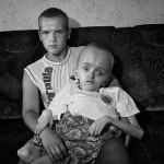 Csernobil áldozata